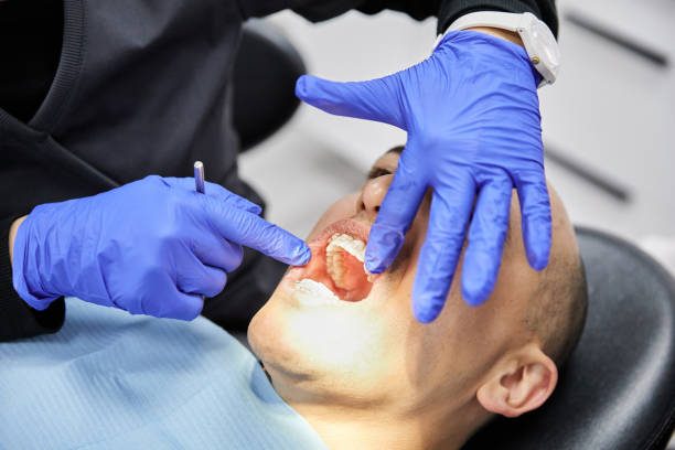 Best Emergency Root Canal Treatment in River Rouge, MI