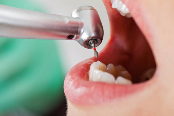 Best Emergency Gum Treatment in River Rouge, MI